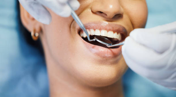 Best Teeth Whitening  in Liberty, TX