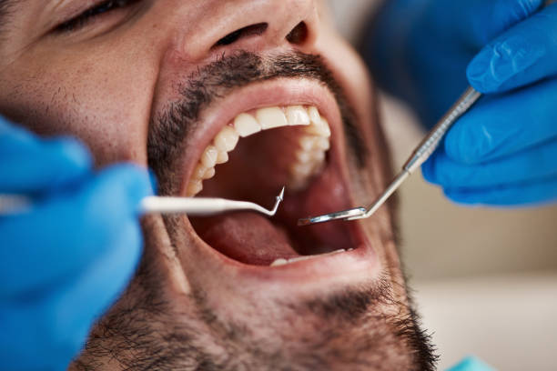 Best Dentist for Tooth Abscess  in Liberty, TX